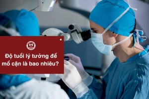 Độ tuổi lý tưởng để mổ cận là bao nhiêu? Chi phí mổ cận mới nhất 2025